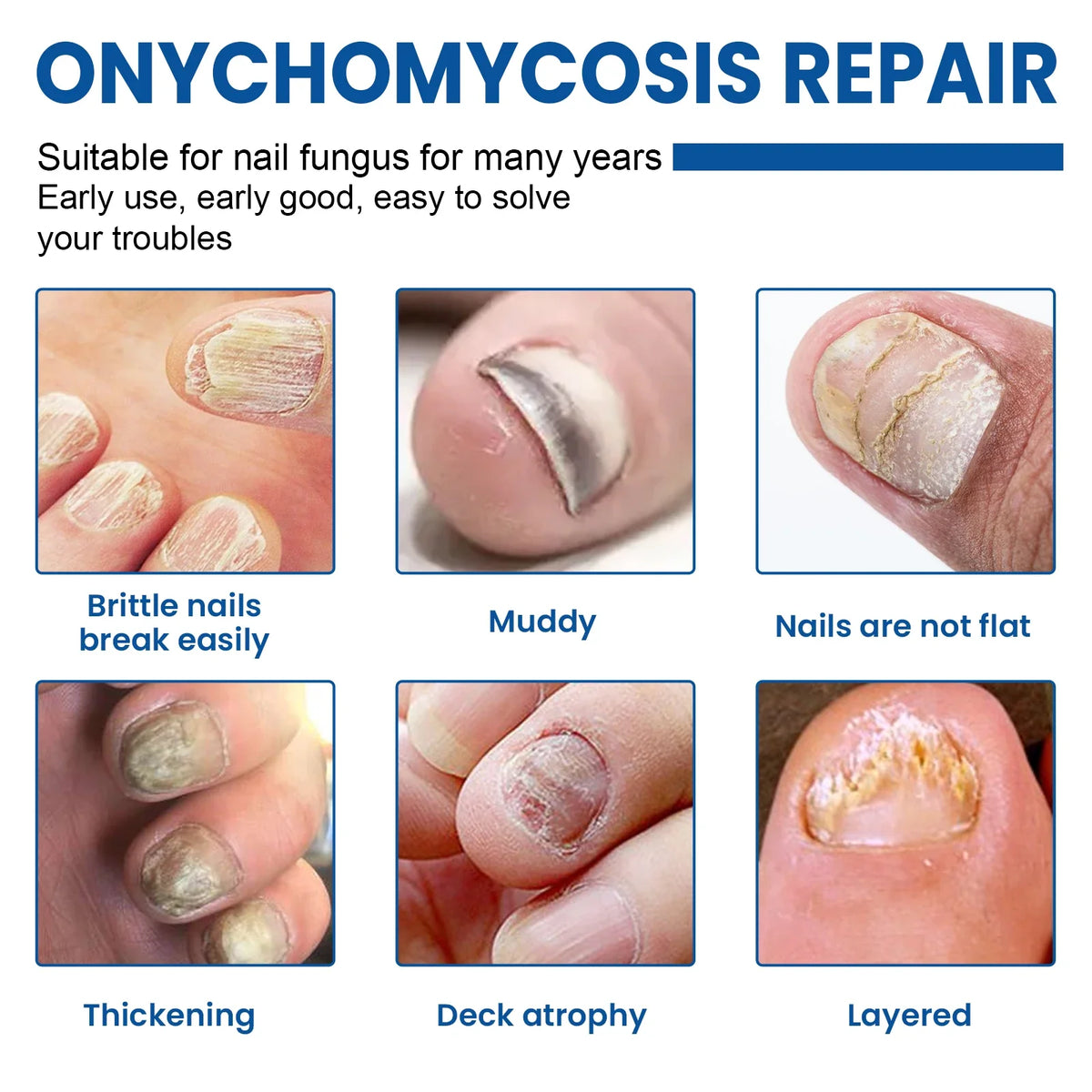 Fungus Nail Repair Patches